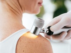 Mit árul el a bőrünk? A melanóma első jelei és a szűrés szerepe melanoma-vizsgalat