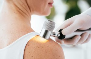 Mit árul el a bőrünk? A melanóma első jelei és a szűrés szerepe melanoma-vizsgalat