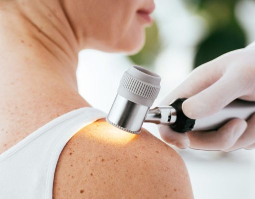 Mit árul el a bőrünk? A melanóma első jelei és a szűrés szerepe melanoma-vizsgalat